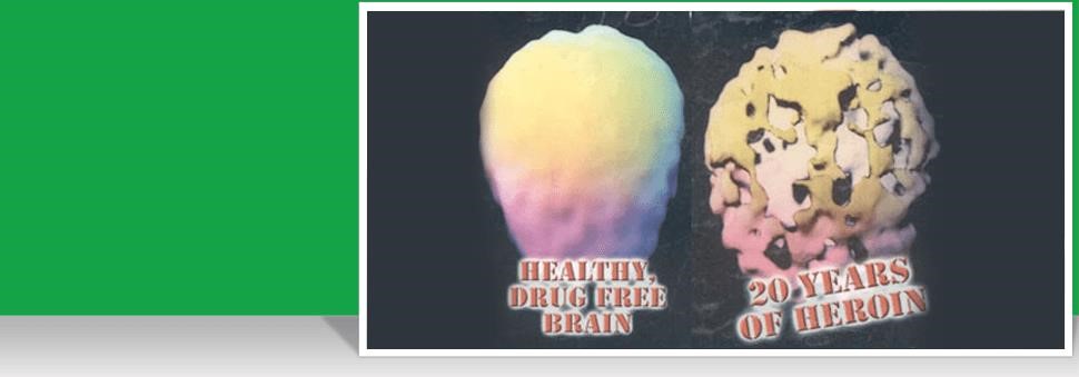 s-methadone University Place WA